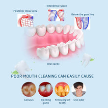 Load image into Gallery viewer, Dental Ultrasonic Plaque/Tartar Scaler & Calculus Stain Remover